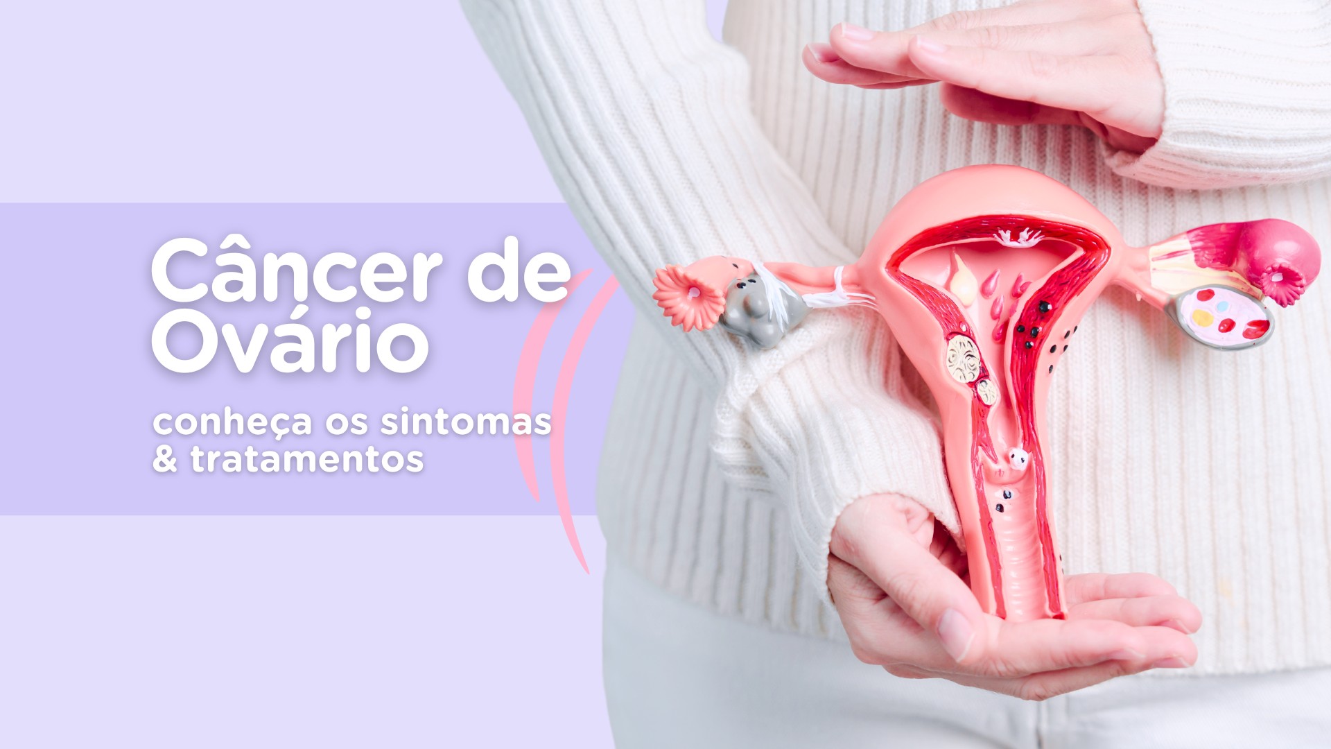 HES e IOS - Cancer de Ovario - Capas Blog Maio 2024